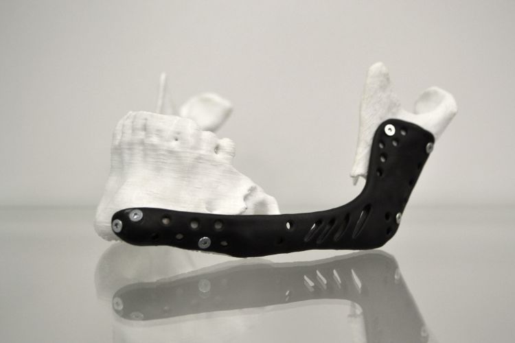 Endless Possibilities: